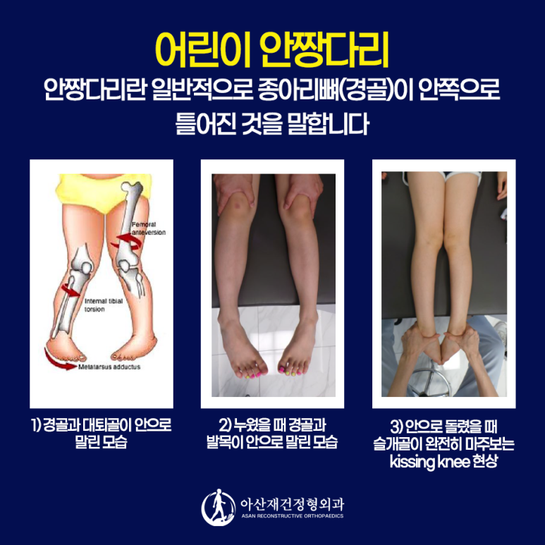 양주정형외과, 양주체형교정, 양주안짱다리교정, 양주오다리교정, 양주엑스다리교정, 양주평발교정, 양주깔창, 양주측만증교정