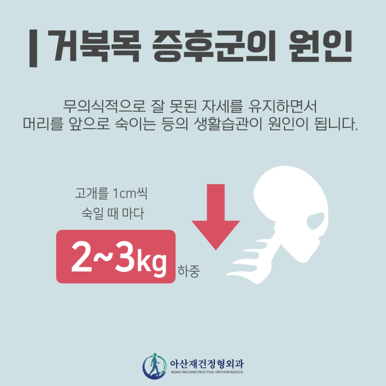 양주거북목증후군, 양주거북목증후근교정, 양주체형교정클리닉, 양주측만증교정센터, 양주평발깔창