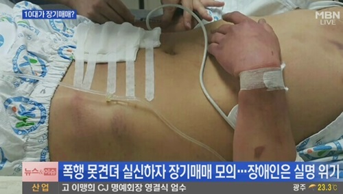 기사의 0번째 이미지