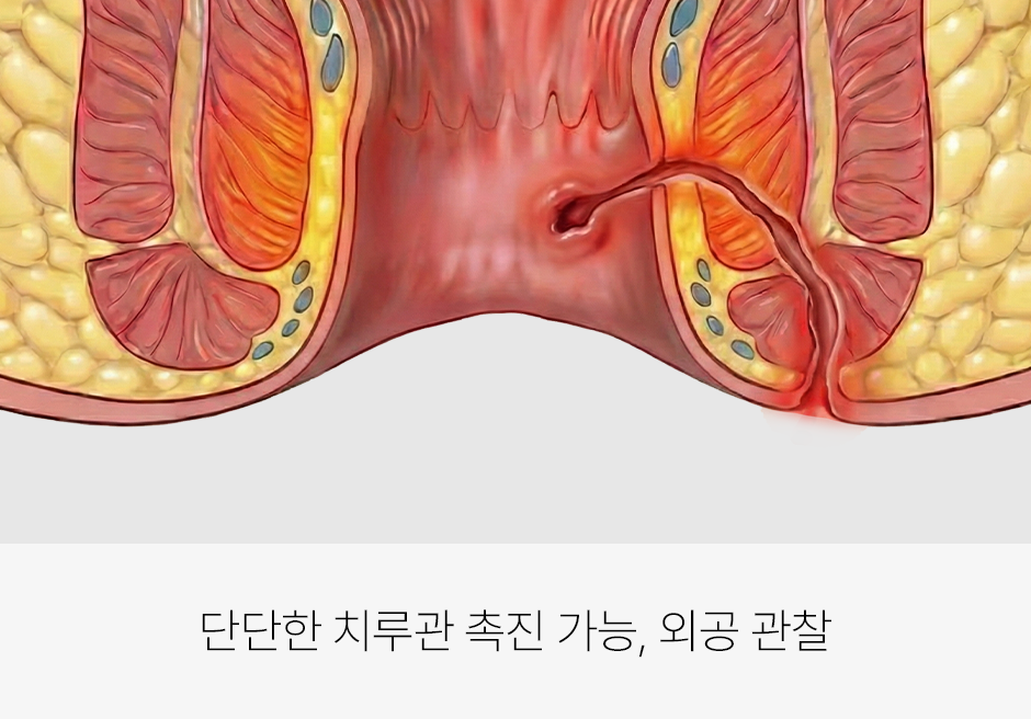 증상 이미지 4