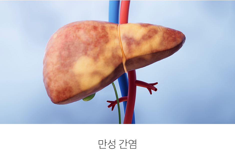 증상 이미지 4