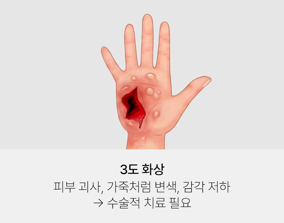 증상 이미지 3