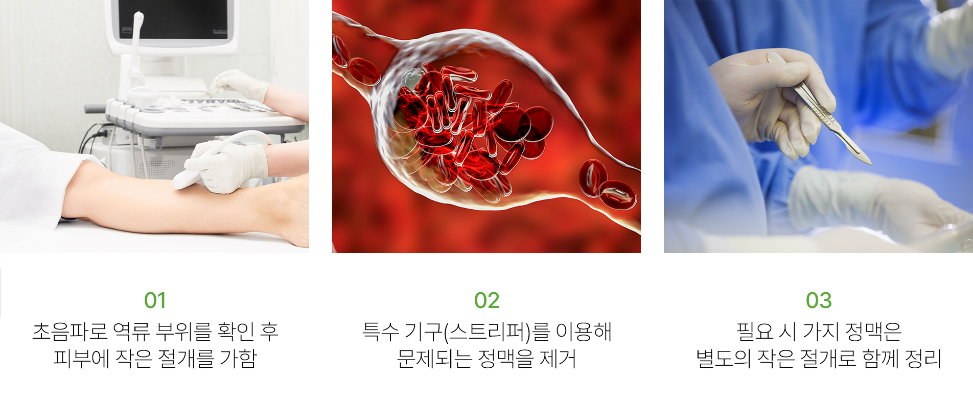 상단 이미지