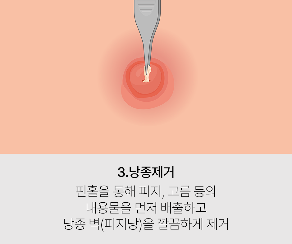 증상 이미지 3