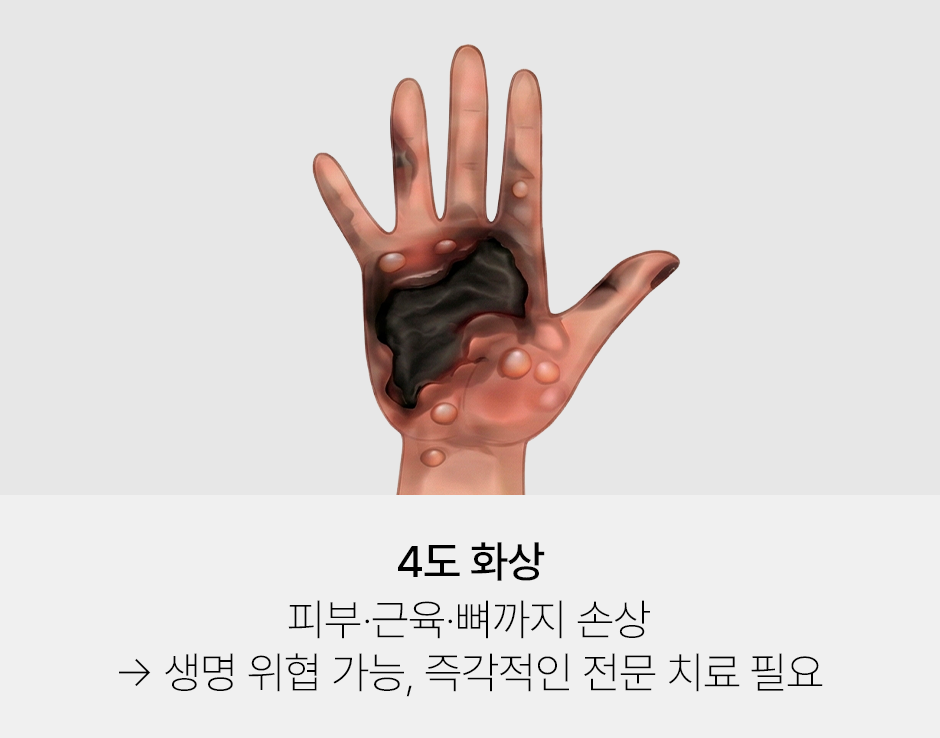 증상 이미지 4