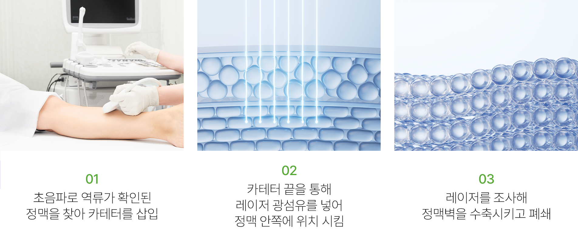 상단 이미지