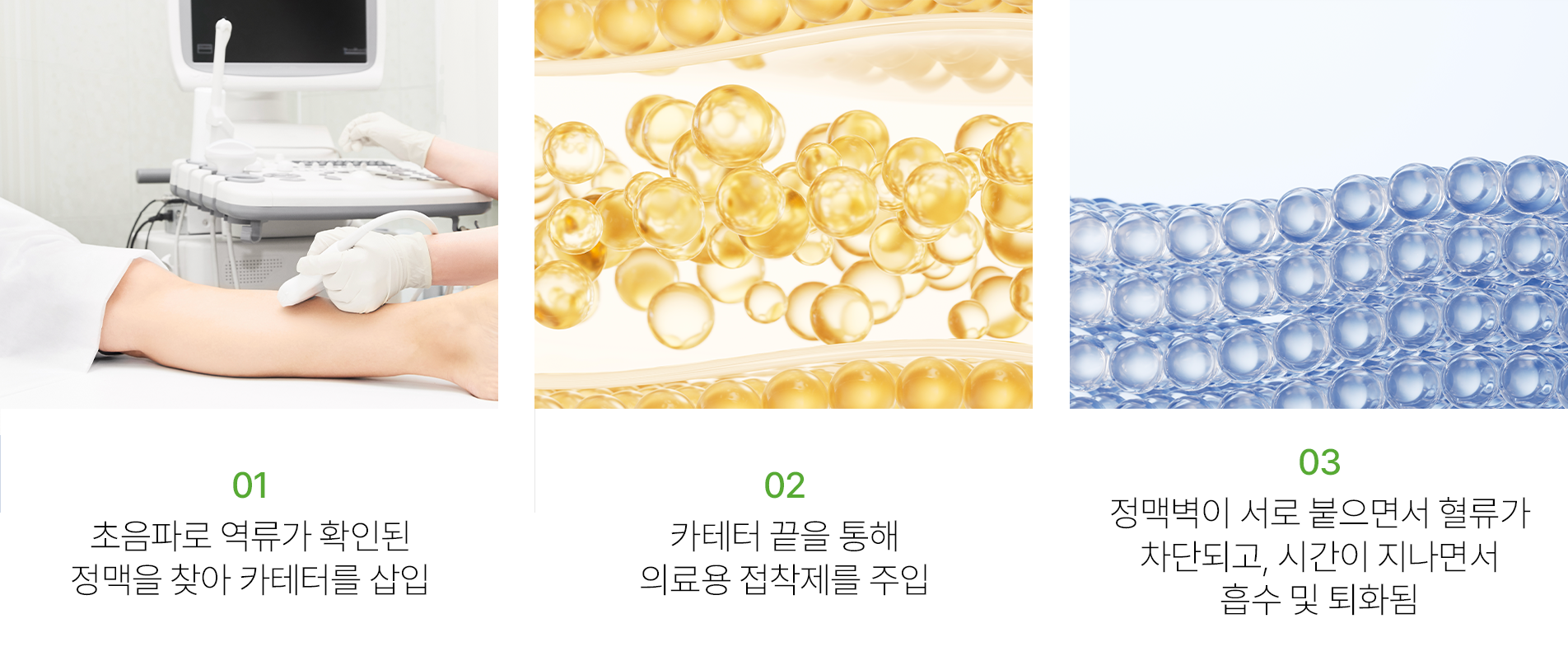 상단 이미지
