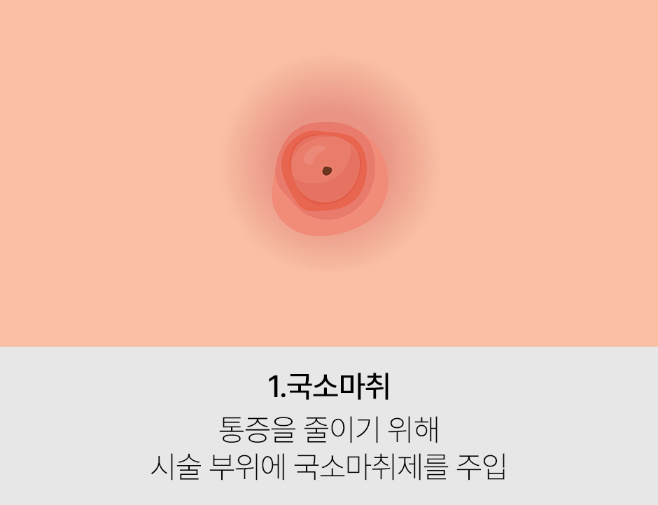증상 이미지 1