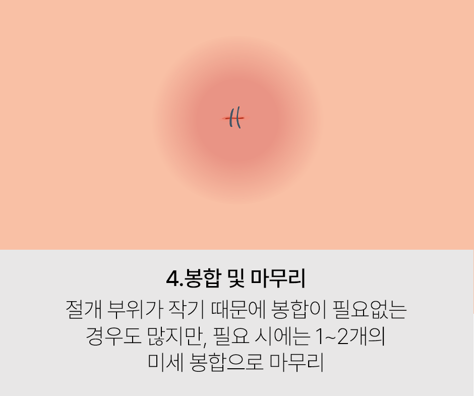 증상 이미지 4