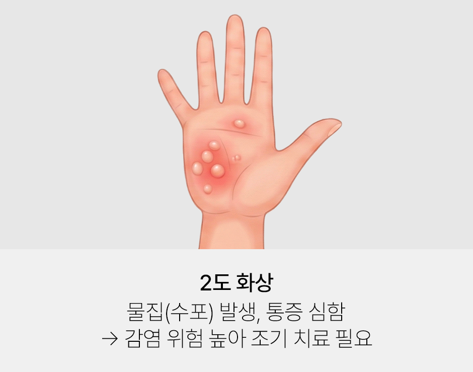 증상 이미지 2