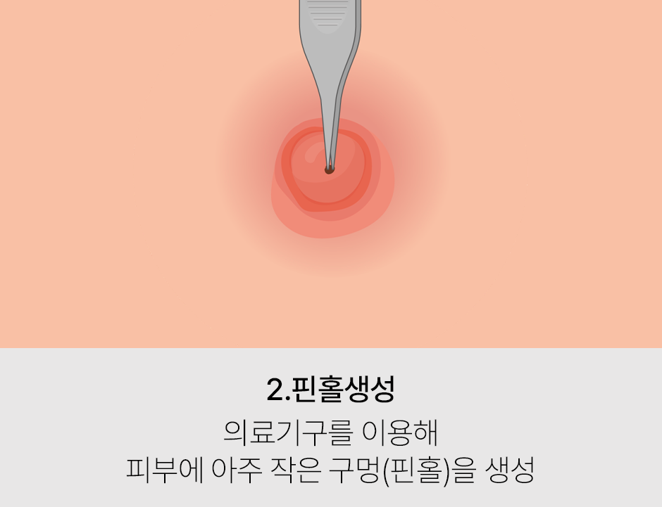 증상 이미지 2