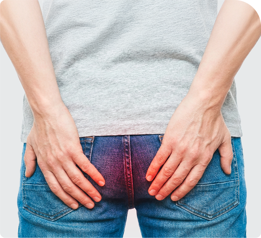 치핵 설명 이미지