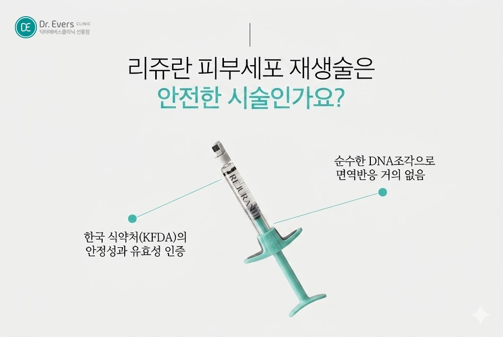 리쥬란 종류 리쥬란힐러 리쥬란아이 리쥬란hb플러스 리쥬란에스 차이 효과_선릉피부과 닥터에버스의원 선릉점