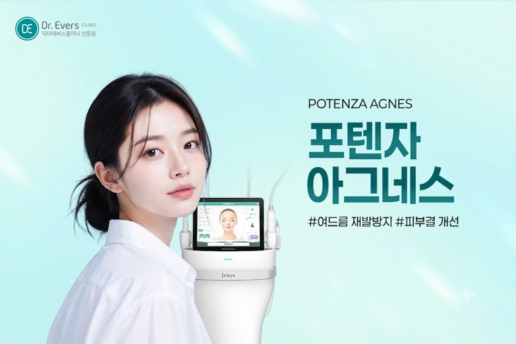 포텐자 프락셀 차이 여드름 패인 흉터 없애는 법— 선릉피부과 닥터에버스의원 선릉점