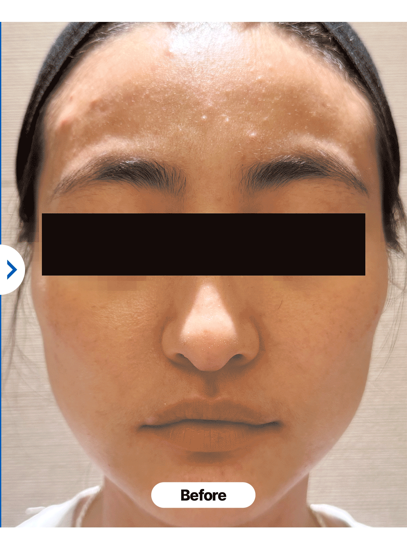 보령머드 버블 톡톡 팩