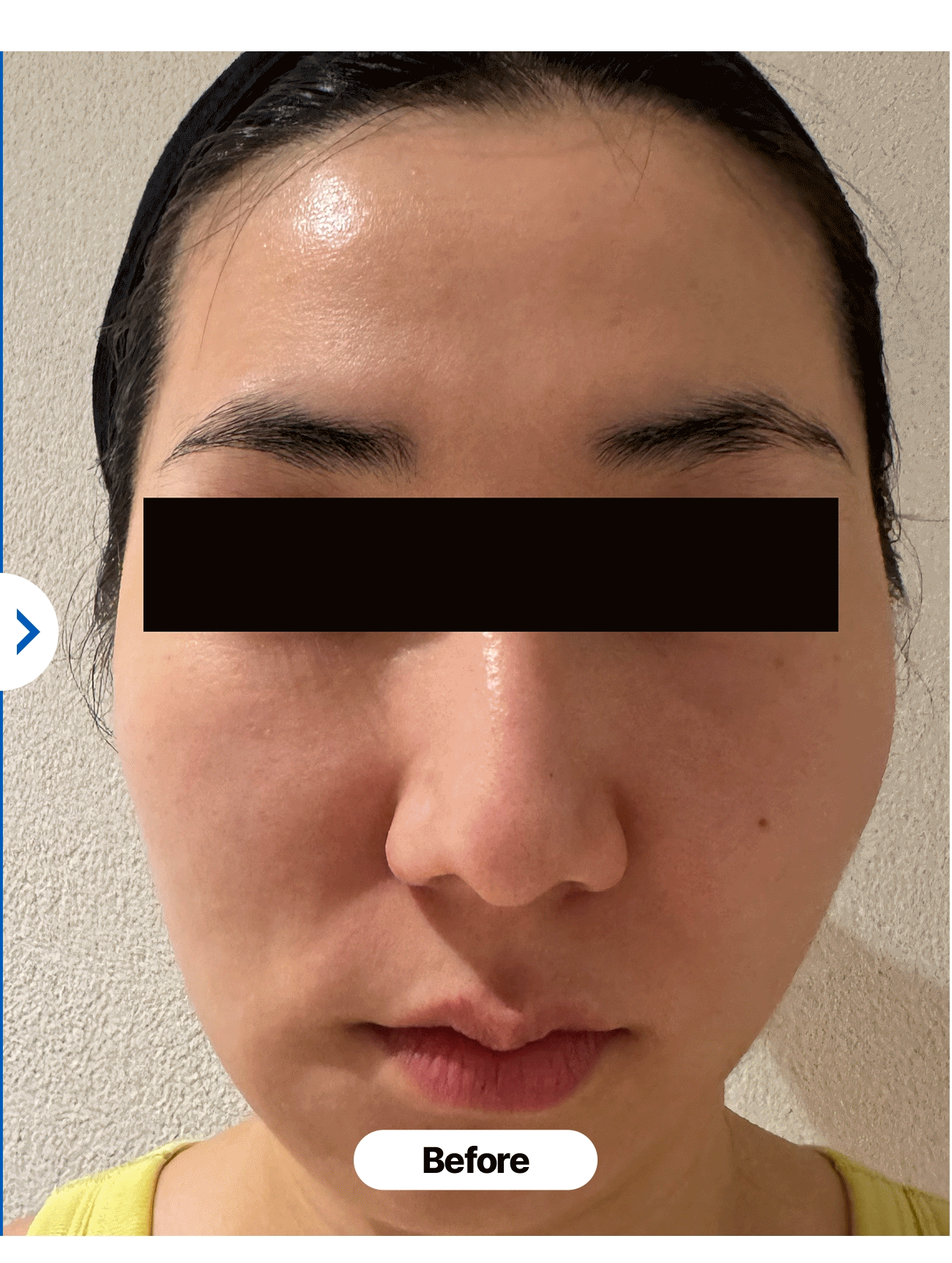 보령머드 버블 톡톡 팩