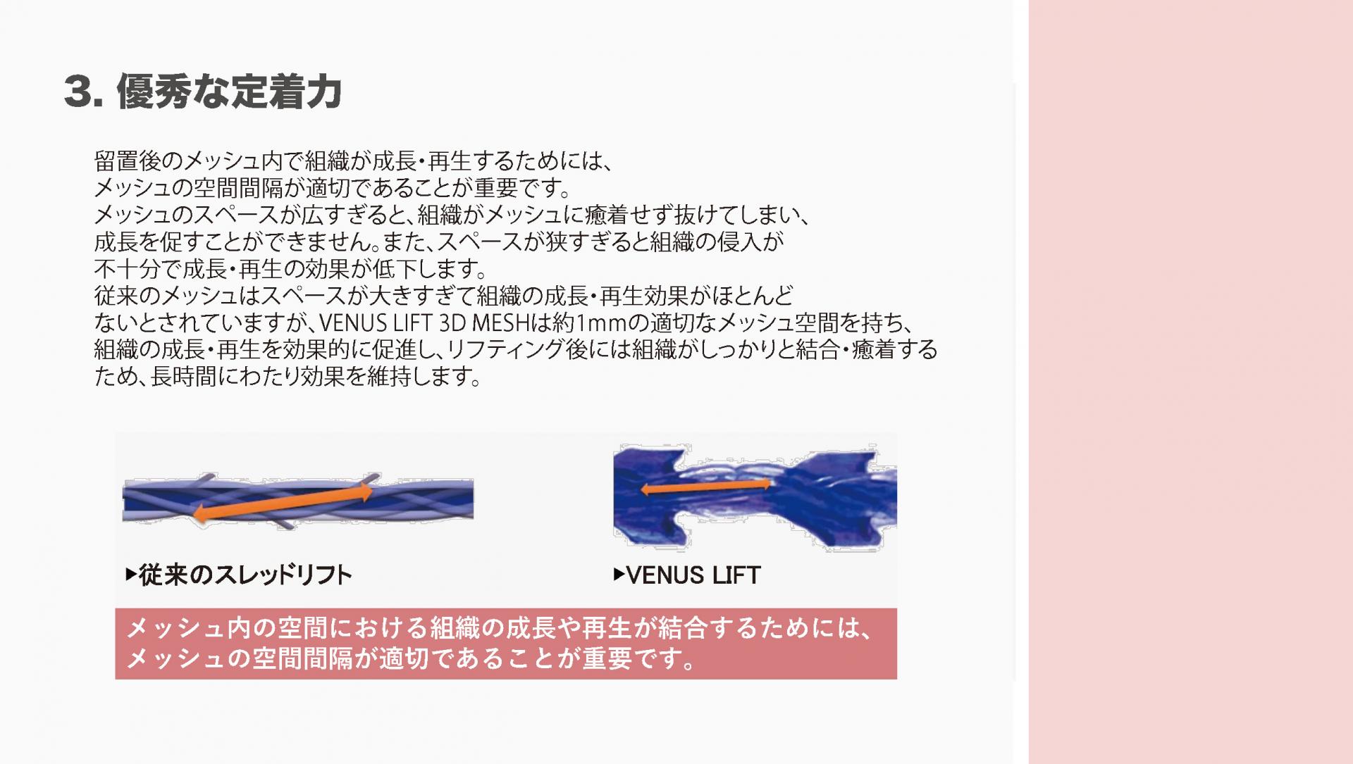 VENUS MEDICAL LIFT PDO 80 / 160