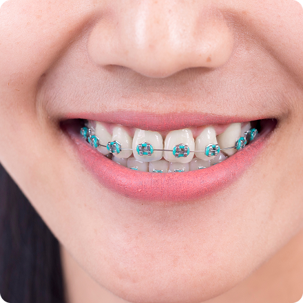 Begin Treatment