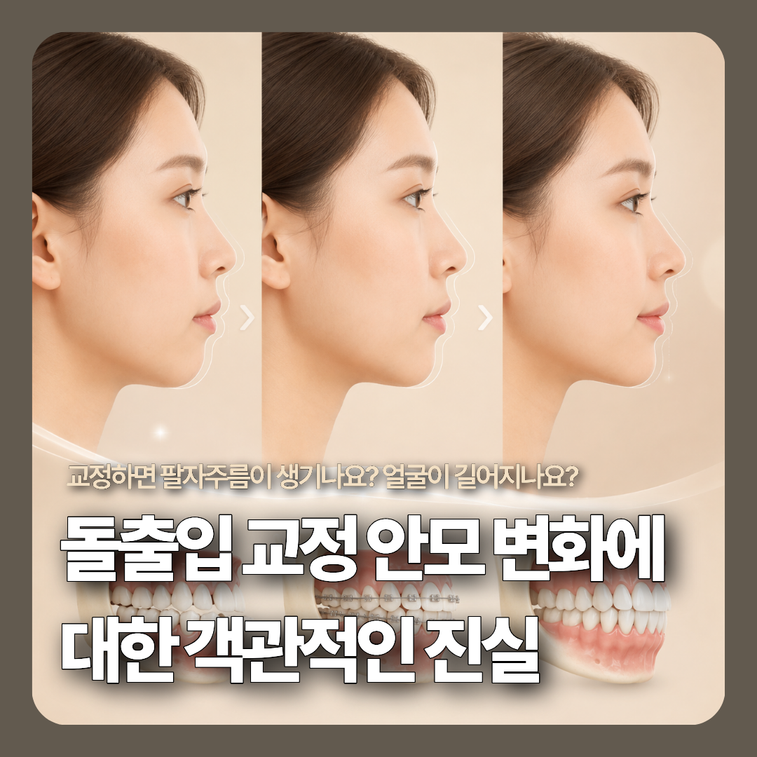 치아교정 후 입술 위치 변화에 따른 측면 안모와 연조직 반응의 다양성을 객관적으로 보여주는 3D 메디컬 일러스트