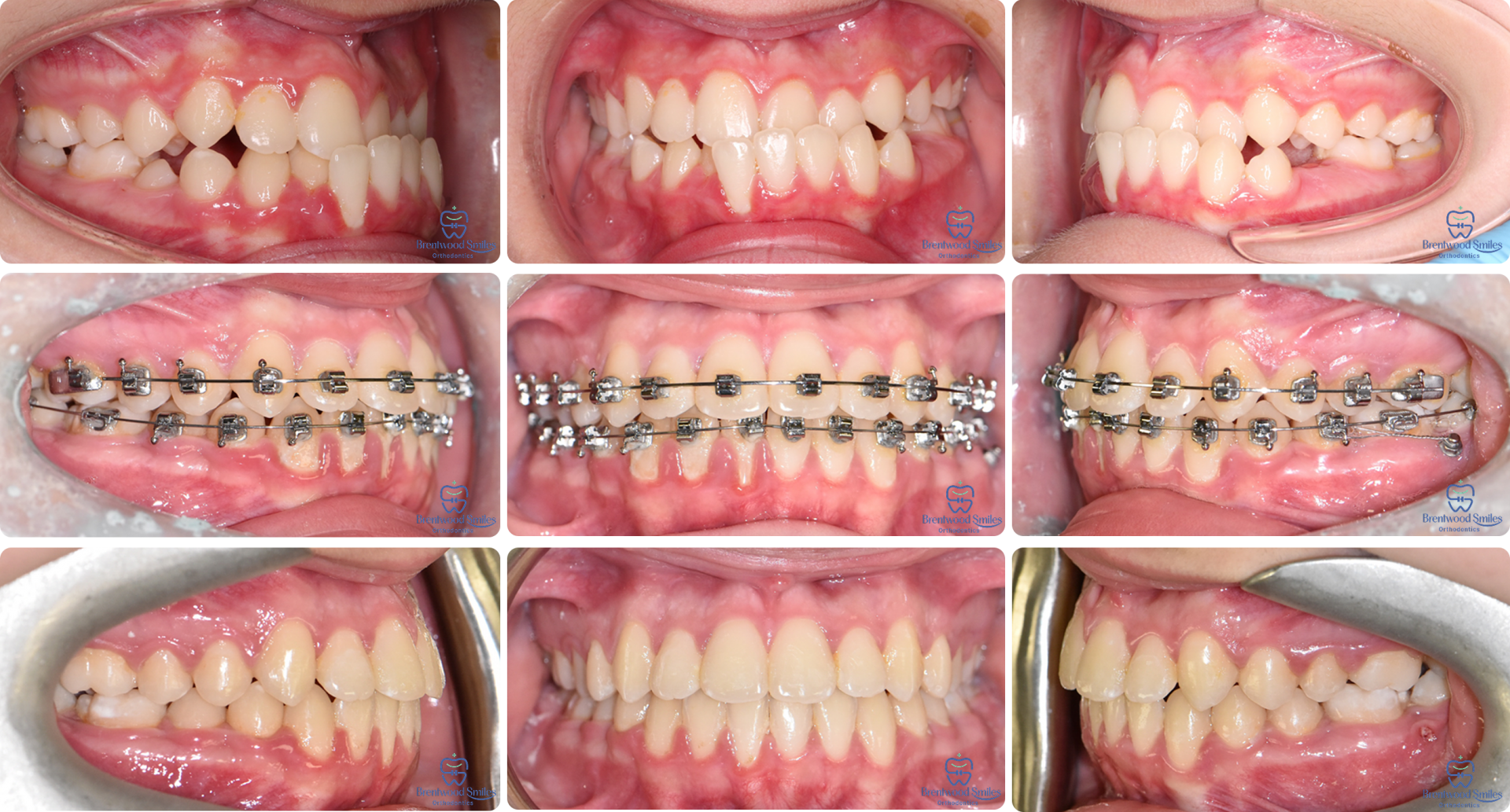 Case 03