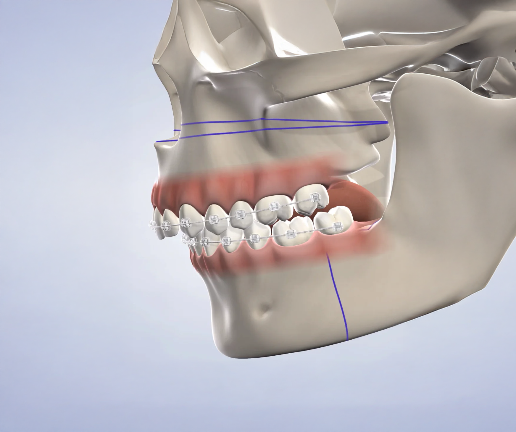 Jaw Skeletal Structure