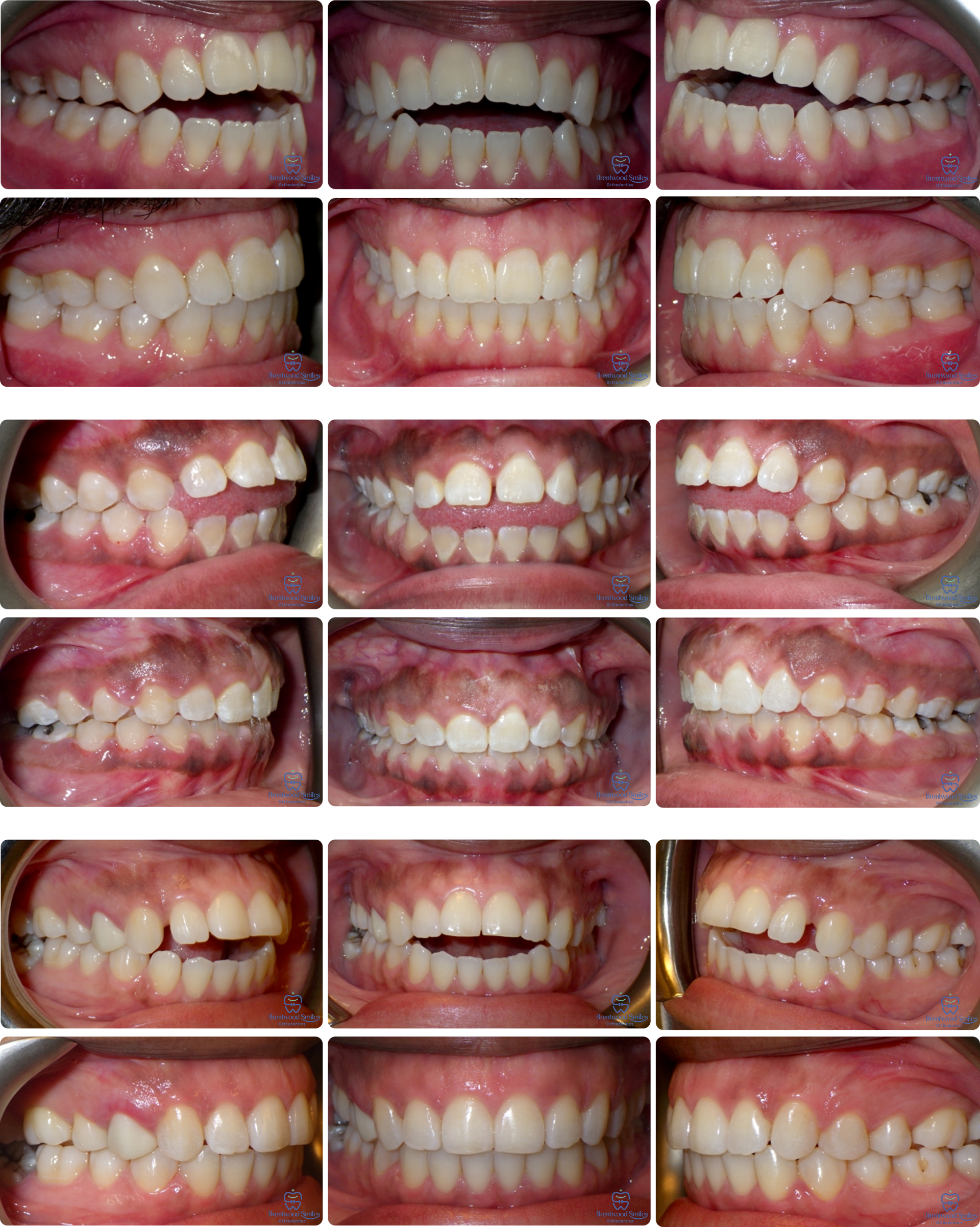 Case 07