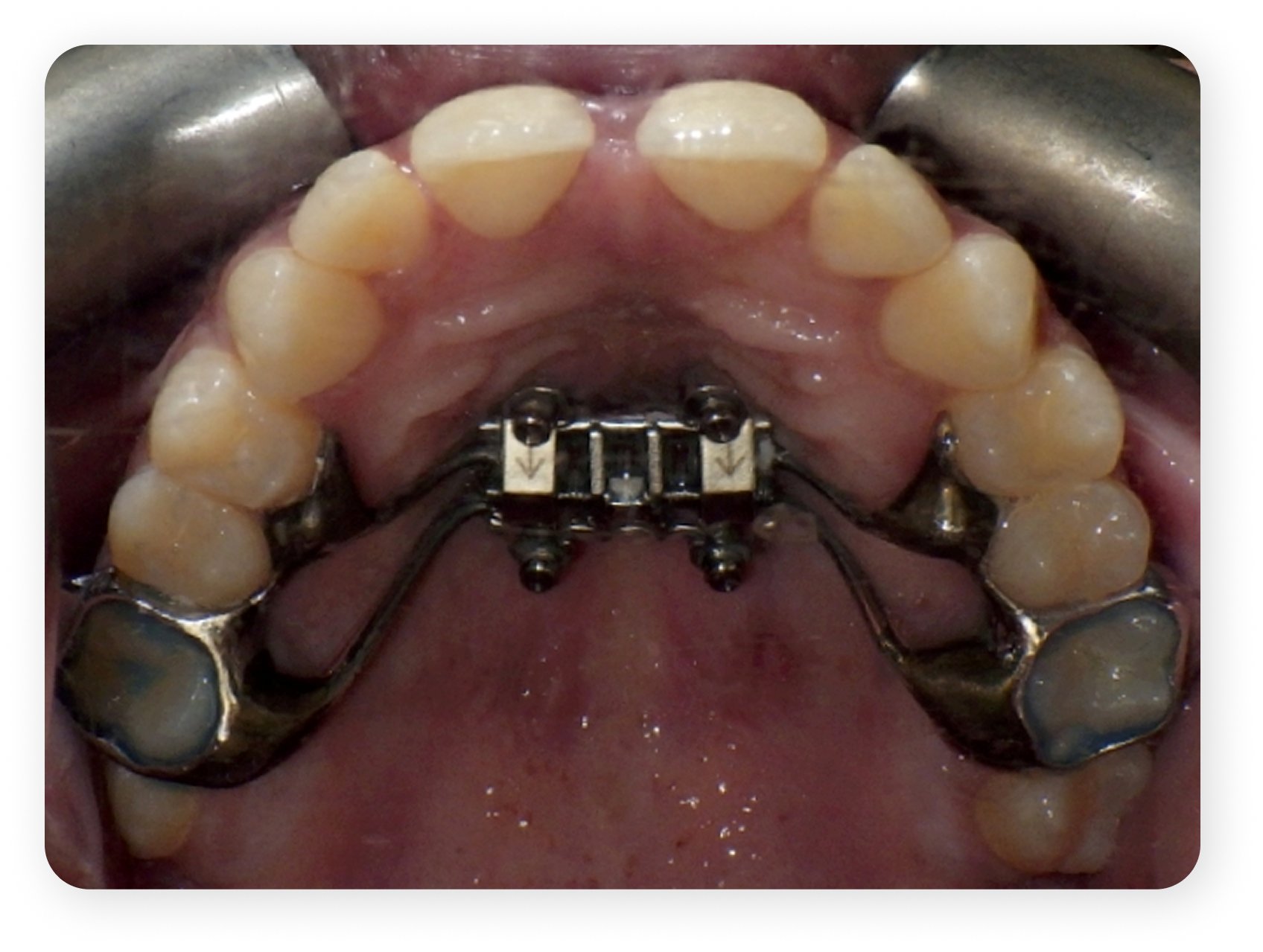 Clinical Case 2