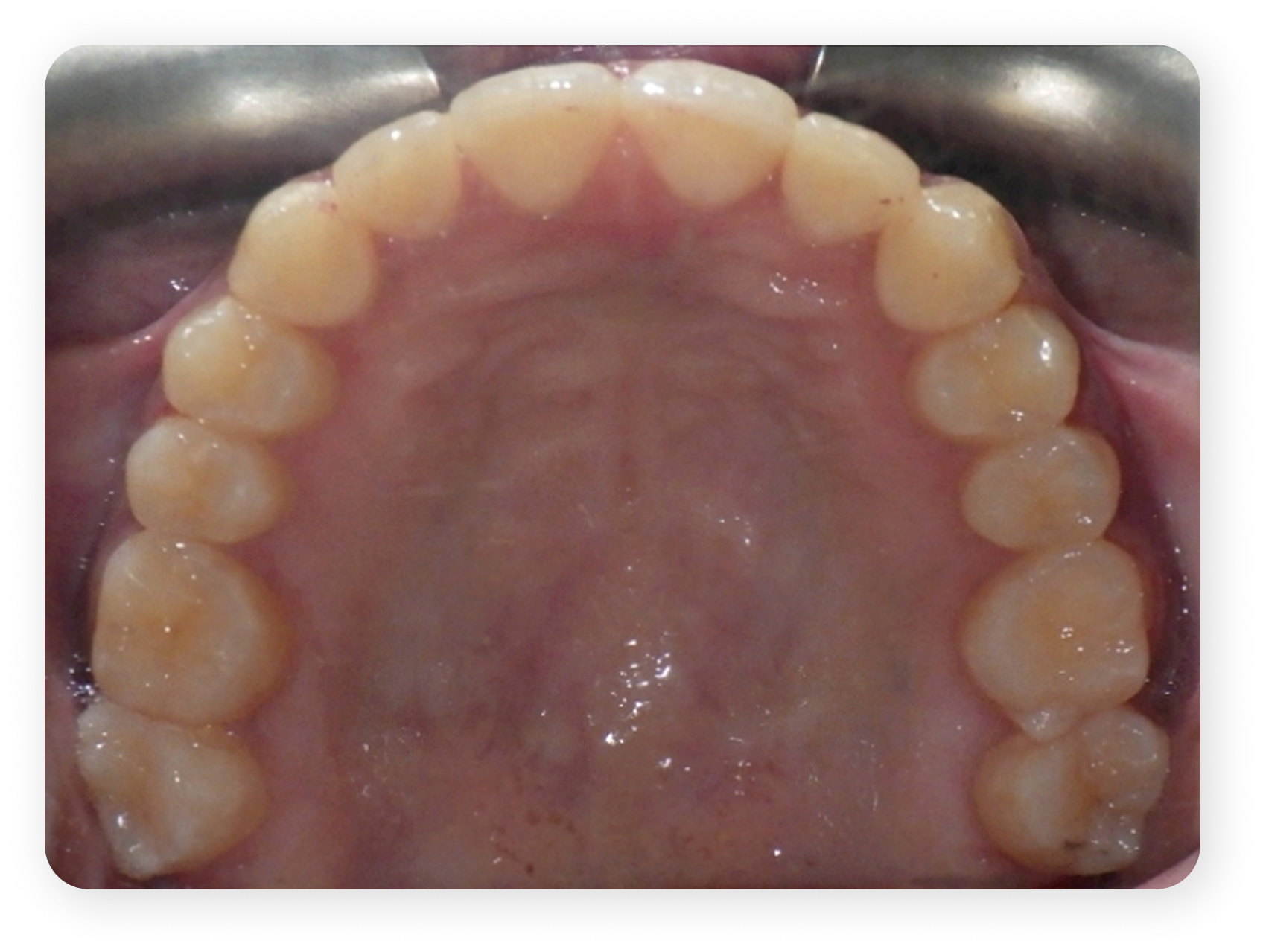 Clinical Case 3