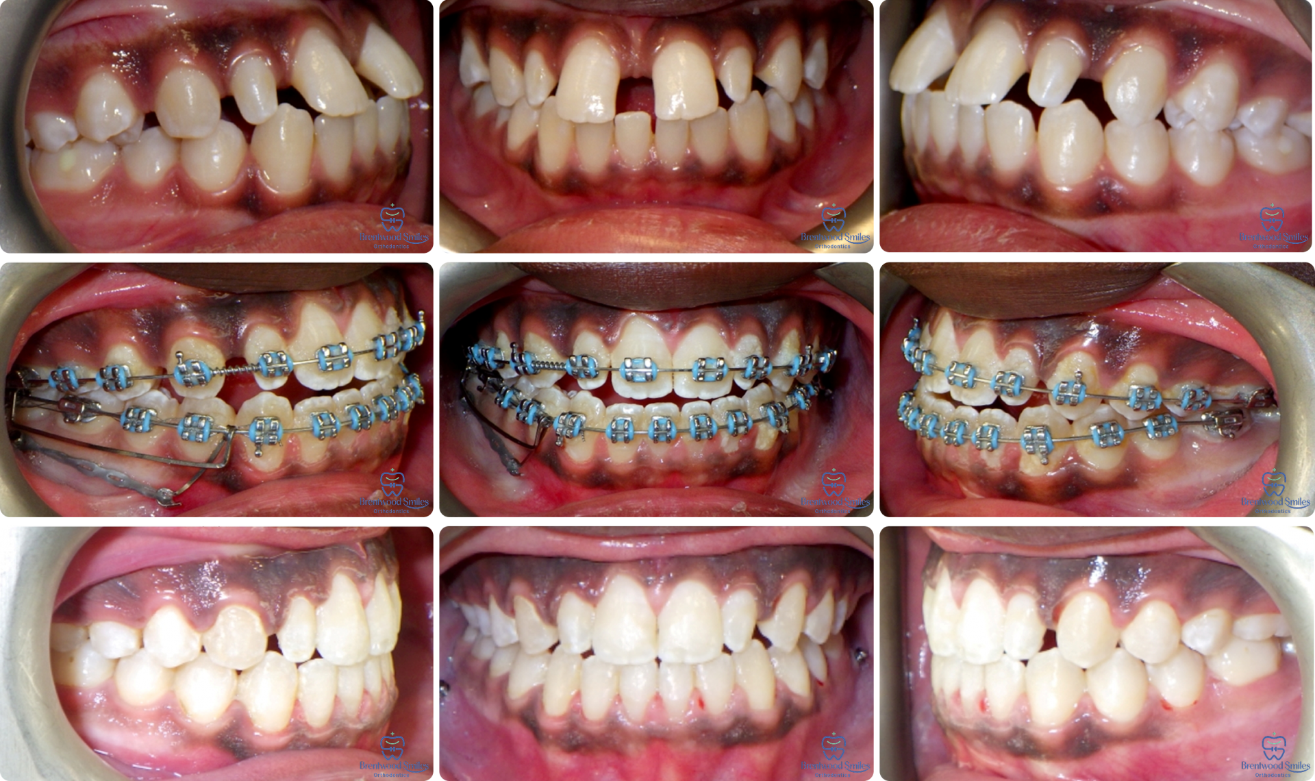 Case 02