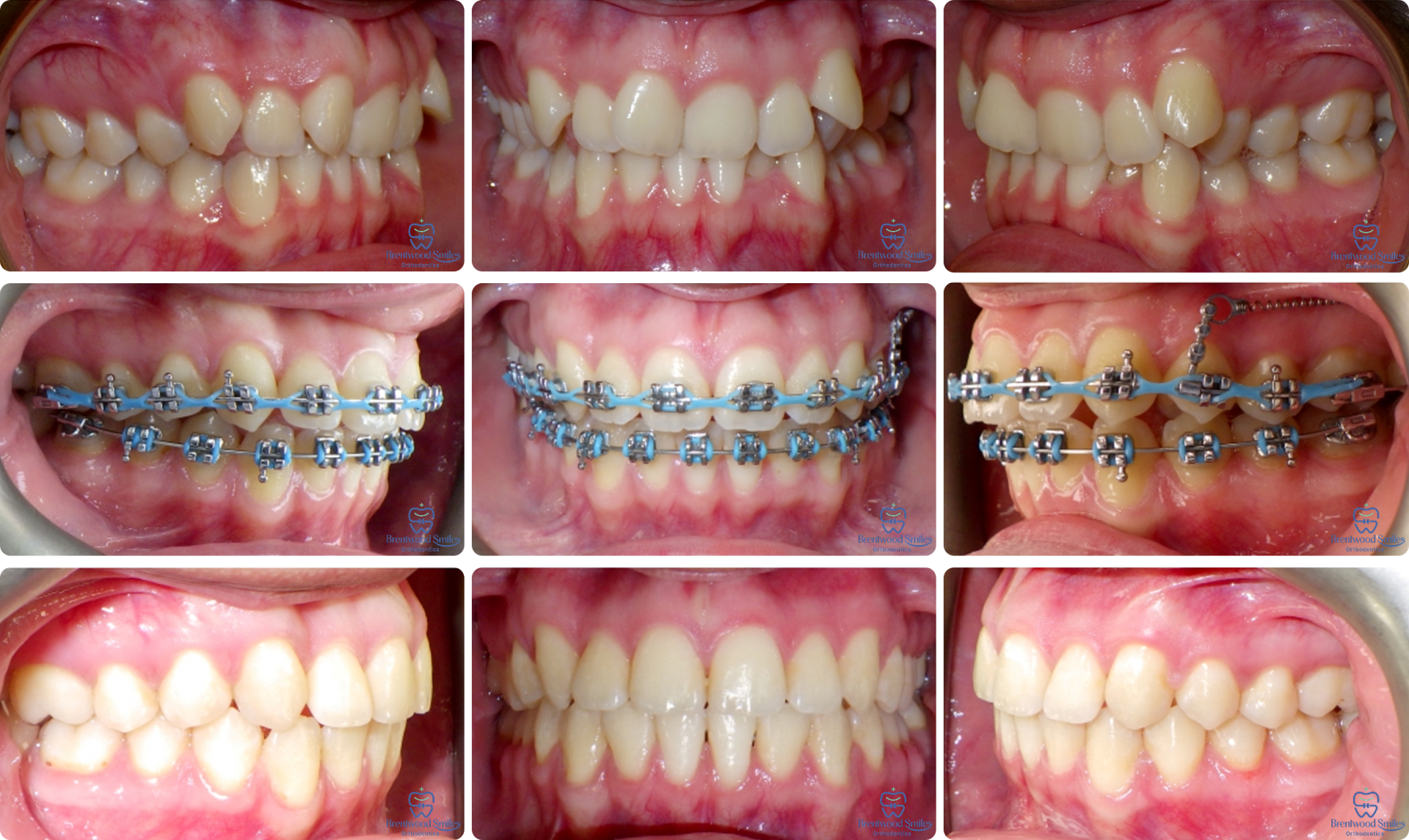 Case 10