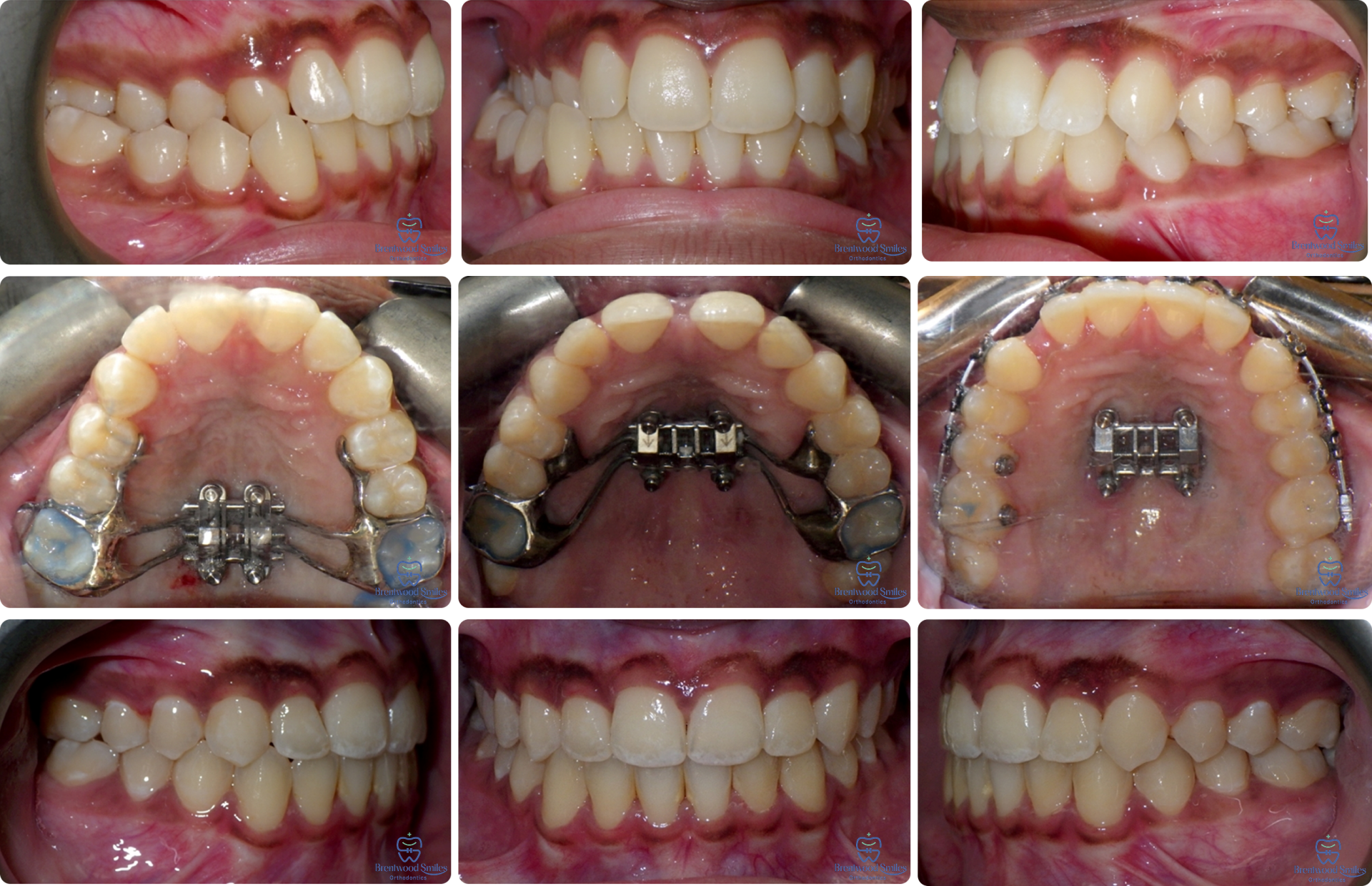 Case 06