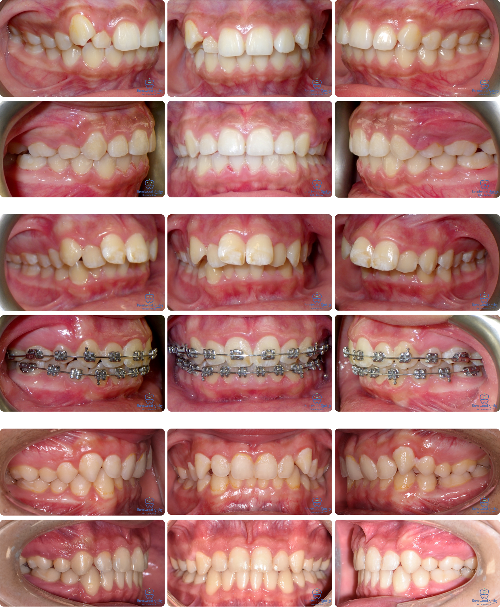 Case 08