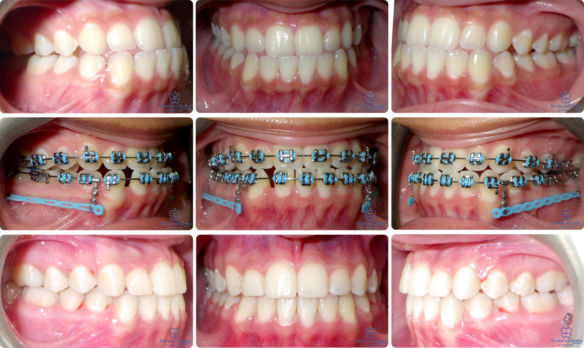 Case 04