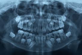 Child First Orthodontic Exam
