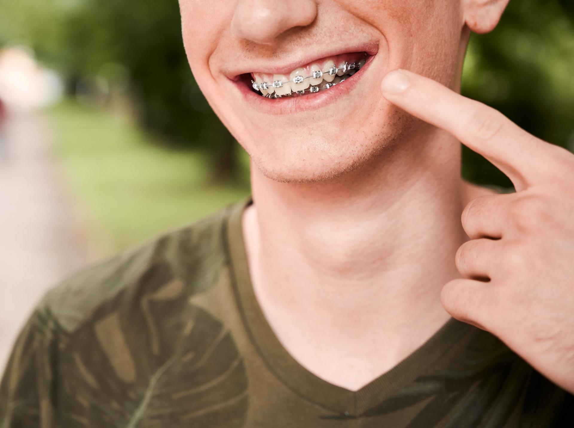 Adult Orthodontic Treatment