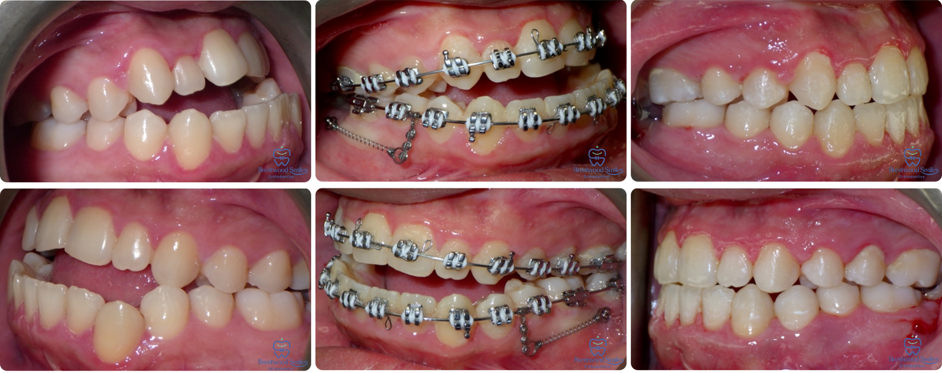 Case 01