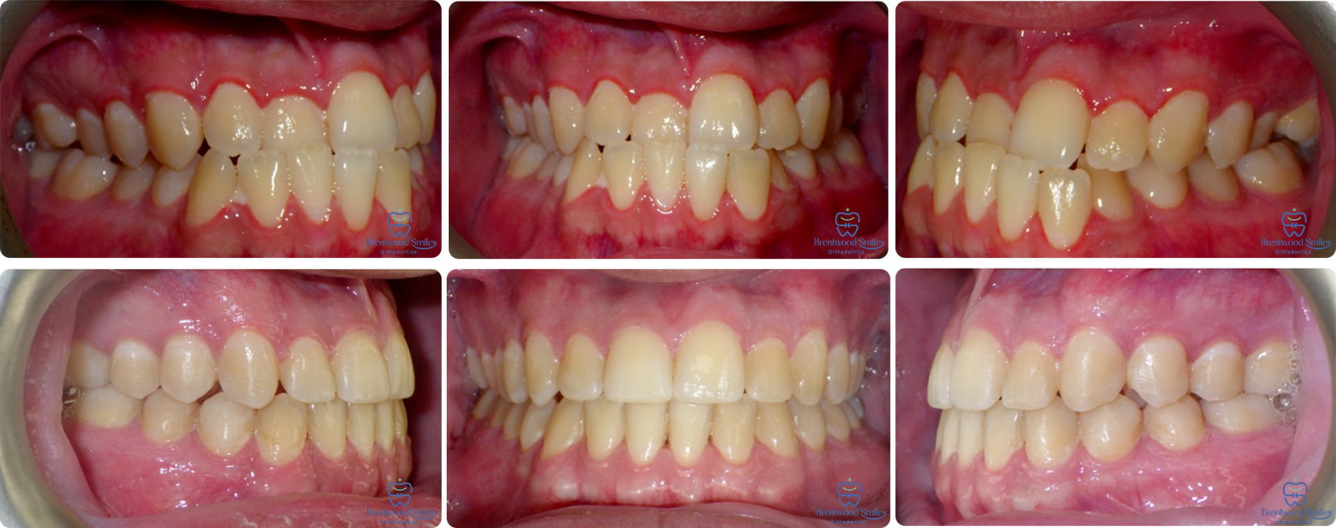 Case 05