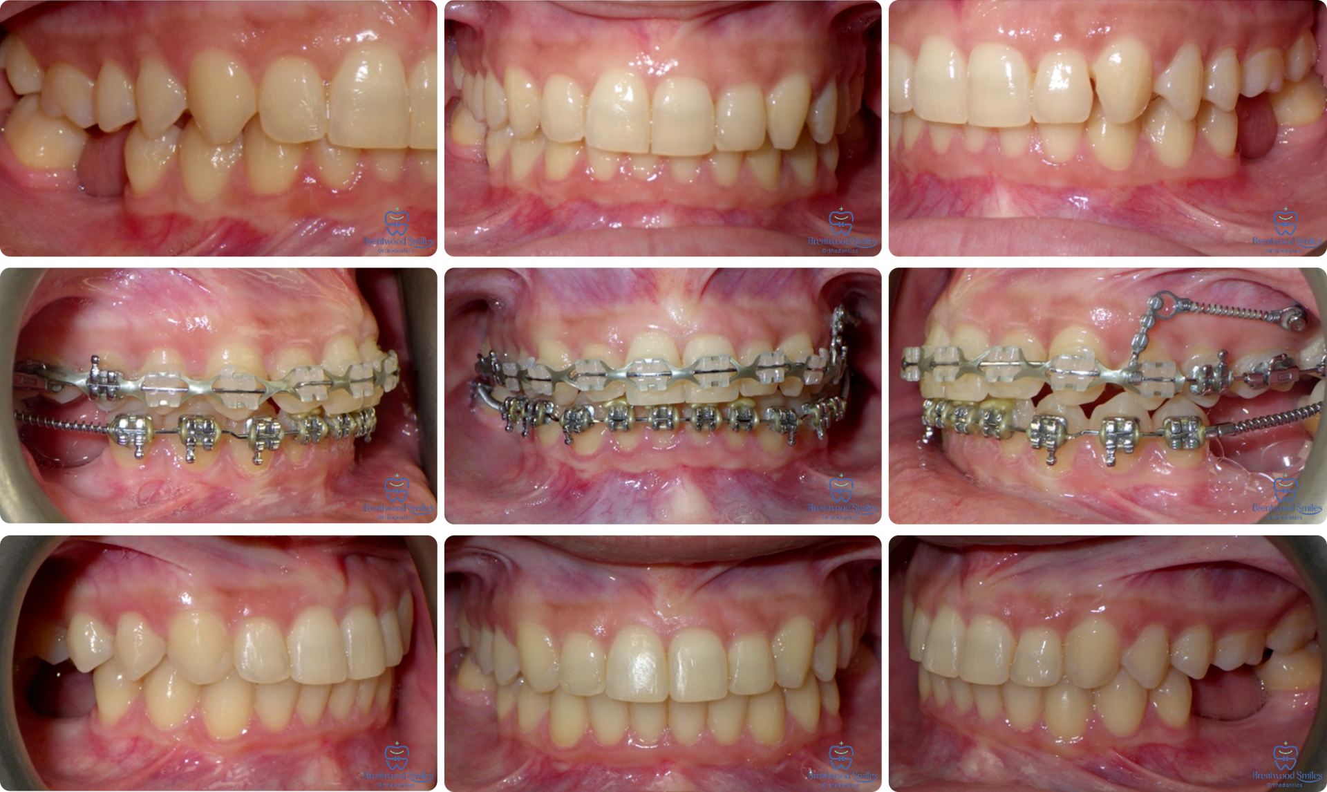 Case 09
