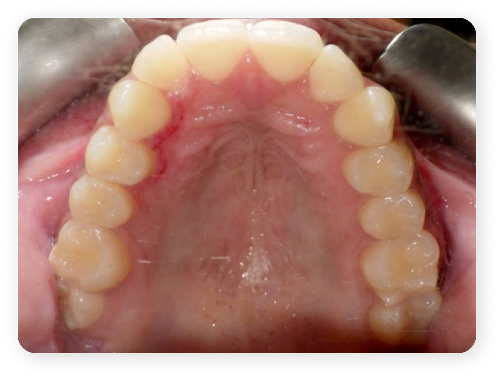 Clinical Case 1
