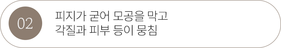 버튼2