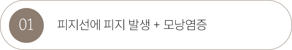 버튼1