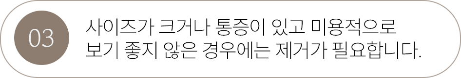 버튼3