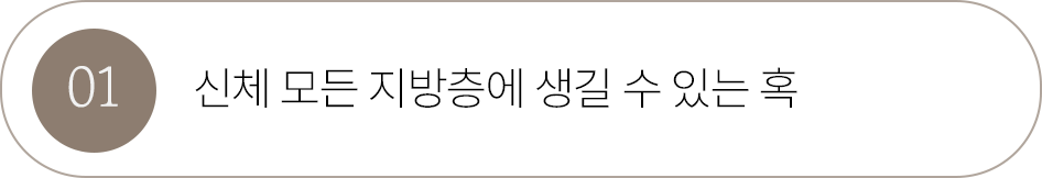 버튼1