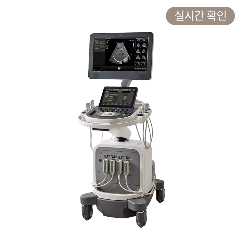 유방 초음파 검사