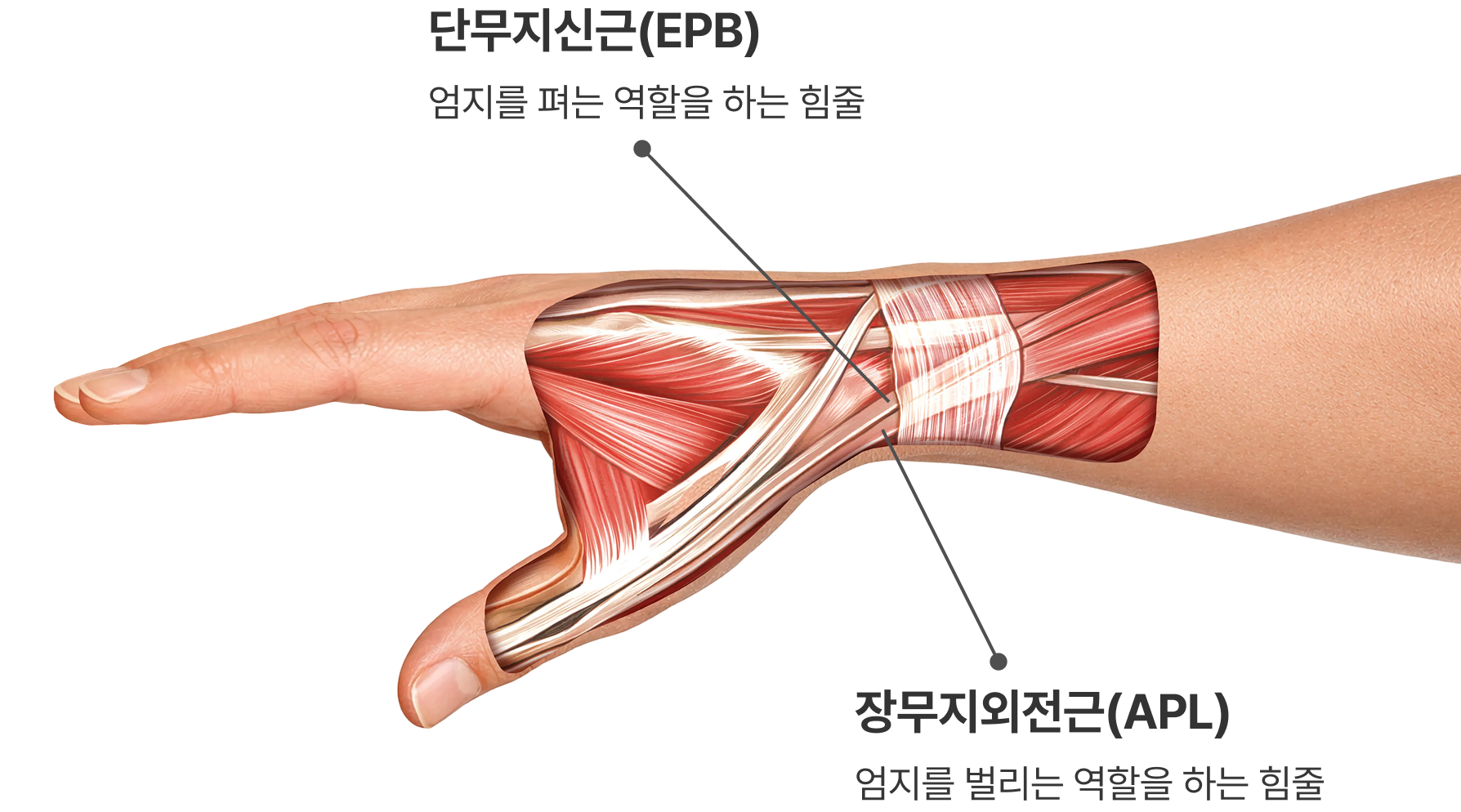 드퀘르뱅 건초염 구조 해부 이미지