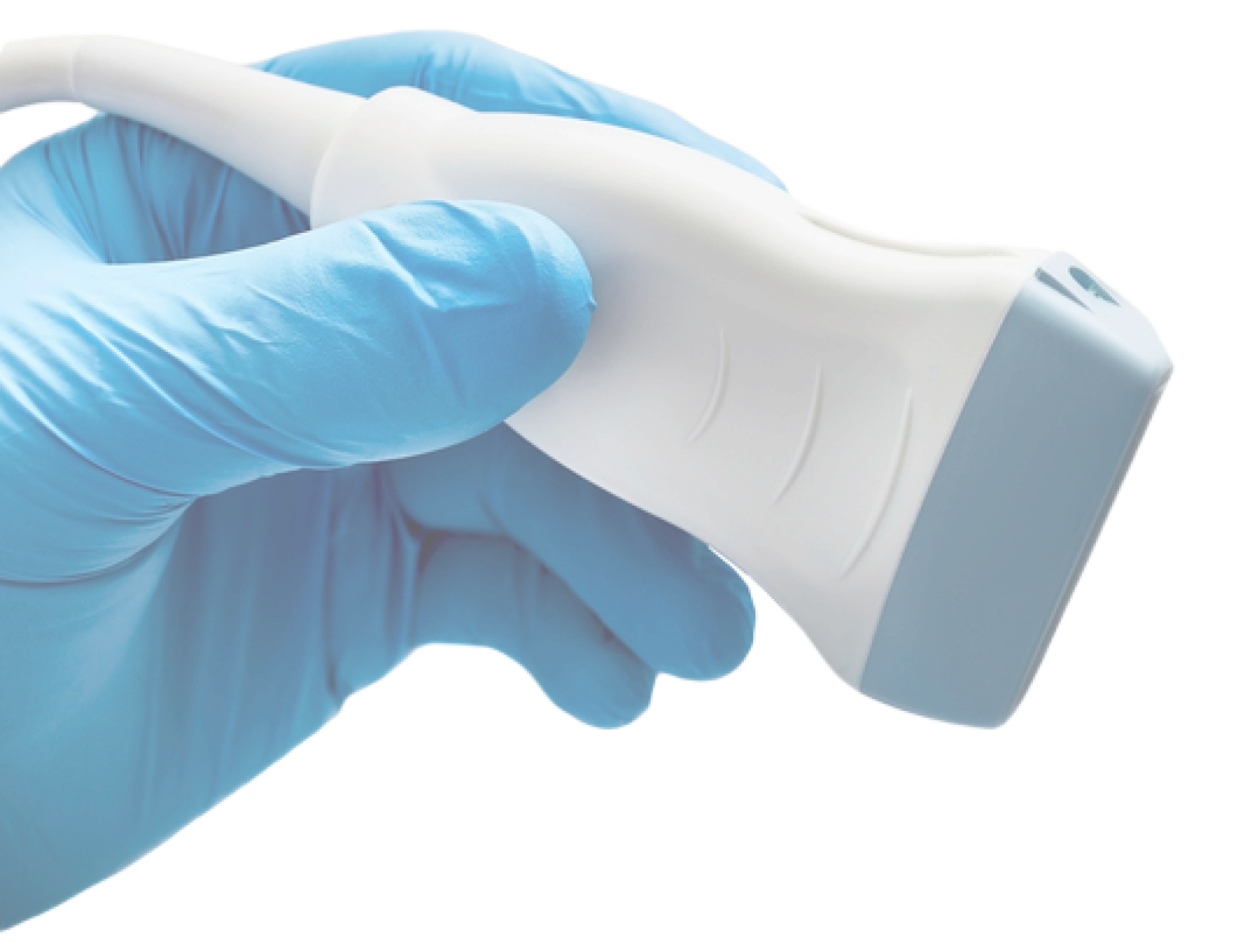 정계정맥류 초음파