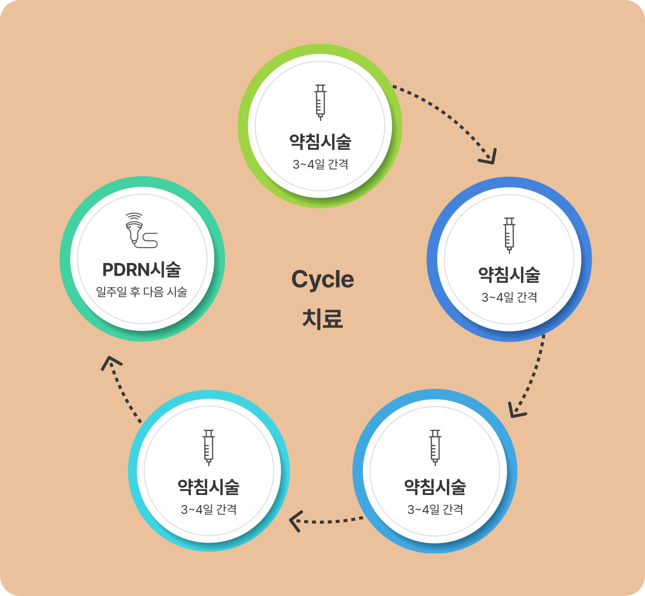 사이클 치료 전체 과정