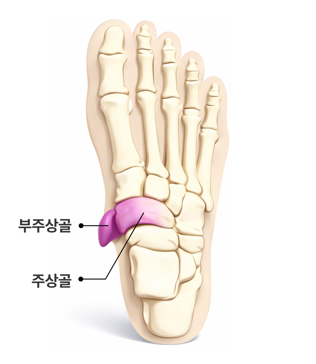 부주상골증후군 해부학 이미지3
