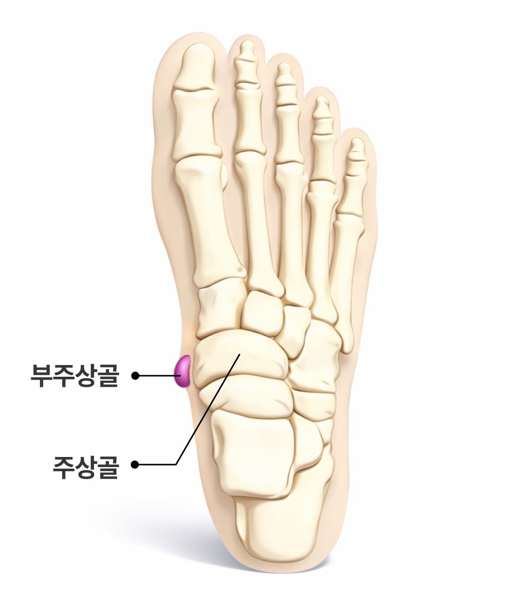 부주상골증후군 해부학 이미지1