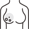 유방갑상선 OFF